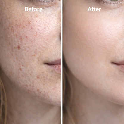 CopperLift Peptide Renewal Serum with Hyaluronic Acid